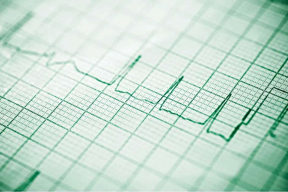 Eletrocardiograma
