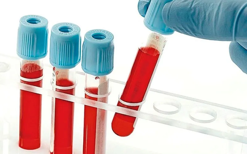 Exames laboratoriais